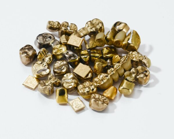 Viele Goldzähne und Goldbrücken liegen zusammen