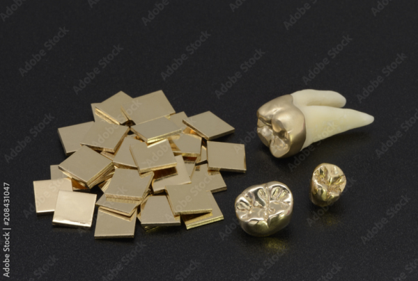 Zahngold, Goldzahn, Goldbrücken, GvG Pforzheim Goldverwertungsgesellschaft mbh